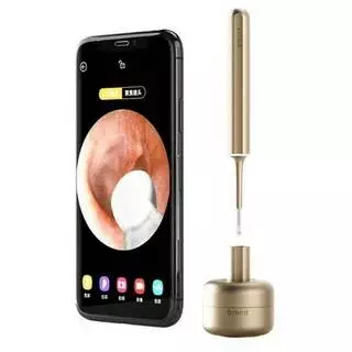 Умная ушная палочка Bebird Smart Ear Cleaning Camera Endoscope X17 Pro Gold (Золотой) CN