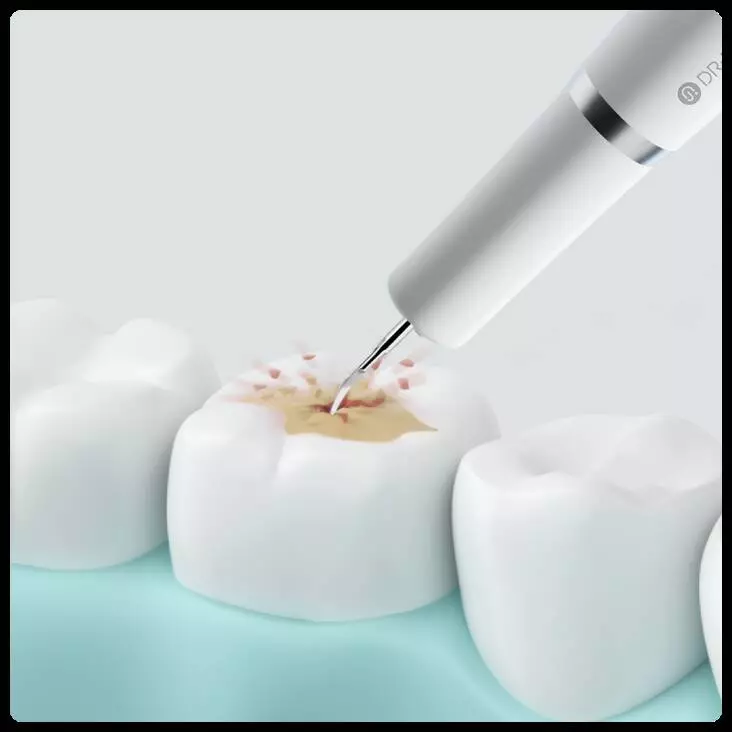 Прибор для удаления зубного камня Xiaomi Dr.Bei Ultrasonic Dental Cleaner YC2 White (Белый) Прибор для удаления зубного камня Xiaomi Dr.Bei Ultrasonic Dental Cleaner YC2 White (Белый)