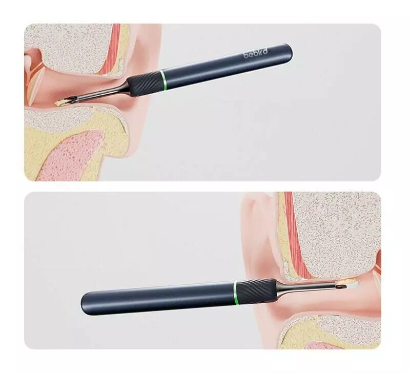 Умная ушная палочка Bebird Ear Visual Picking Stick Note 5 Pro Blue (Синий) Умная ушная палочка Bebird Ear Visual Picking Stick Note 5 Pro Blue (Синий)