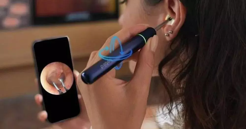 Умная ушная палочка Bebird Ear Visual Picking Stick Note 5 Pro Blue (Синий) Умная ушная палочка Bebird Ear Visual Picking Stick Note 5 Pro Blue (Синий)