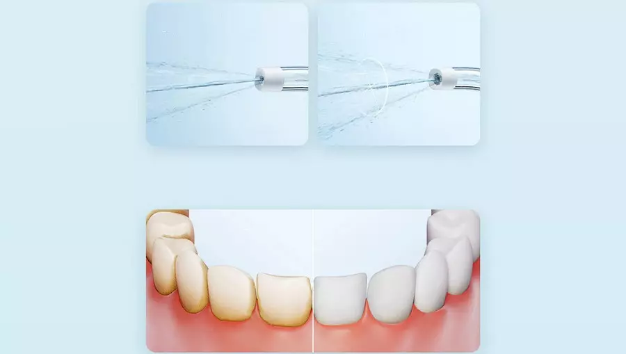 Ирригатор Xiaomi Mijia Electric Teeth Flosser F300 (MEO703) - фото 2 Ирригатор Xiaomi Mijia Electric Teeth Flosser F300 (MEO703) - фото 2