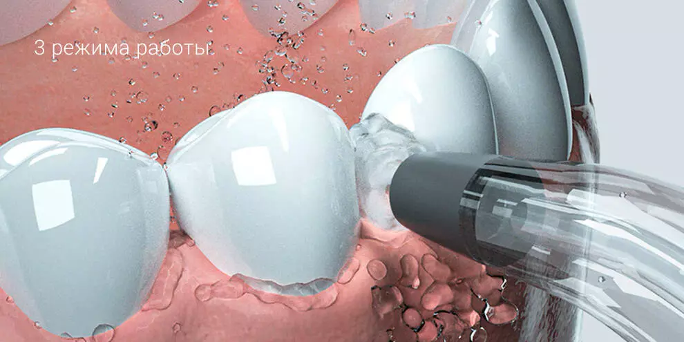 Ирригатор Oclean W1 (2 насадки+футляр) - фото 5 Ирригатор Oclean W1 (2 насадки+футляр) - фото 5