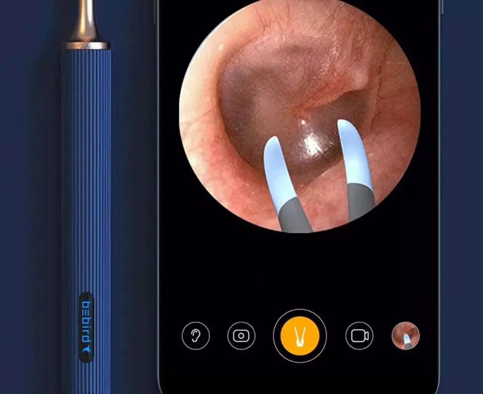 Умная ушная палочка Bebird Smart Visual Ear Stick Note 3 - фото 4 Умная ушная палочка Bebird Smart Visual Ear Stick Note 3 - фото 4