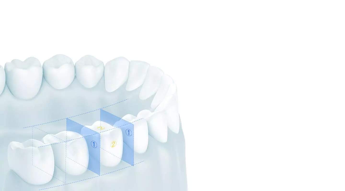 Ирригатор Xiaomi Dr.Bei Water Flosser YMYM-YF3 - фото 3 Ирригатор Xiaomi Dr.Bei Water Flosser YMYM-YF3 - фото 3