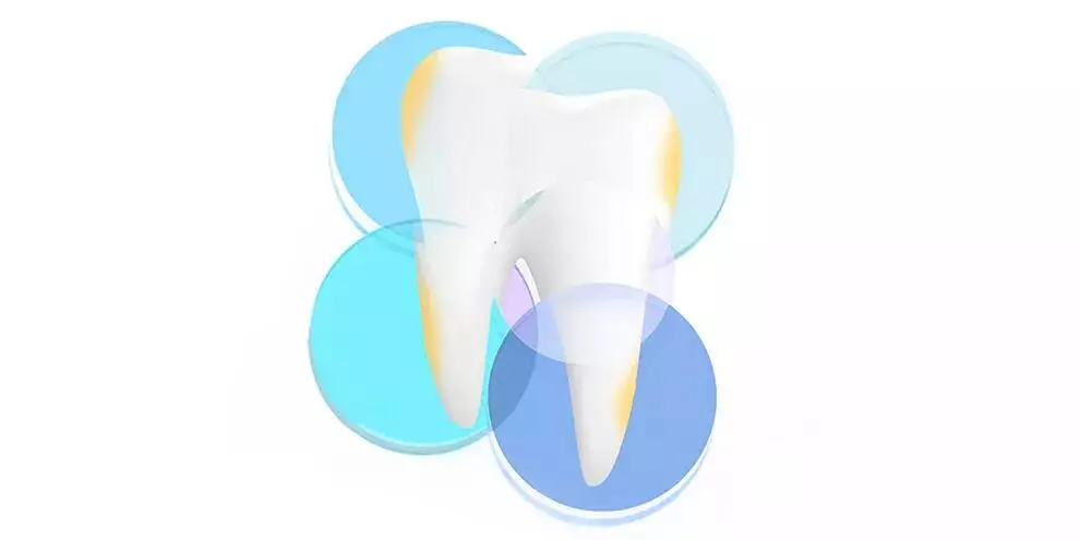 Ультразвуковой аппарат для отбеливания зубов Xiaomi Dr. Bei Sonic W7 Sonic Teeth Apparatus Set - фото 2