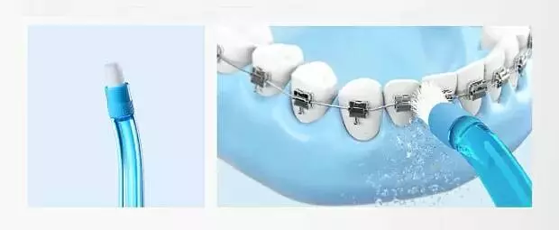 Насадка для ирригатора Soocas W3 ортодонтическая (2 шт) - фото 2 Насадка для ирригатора Soocas W3 ортодонтическая (2 шт) - фото 2