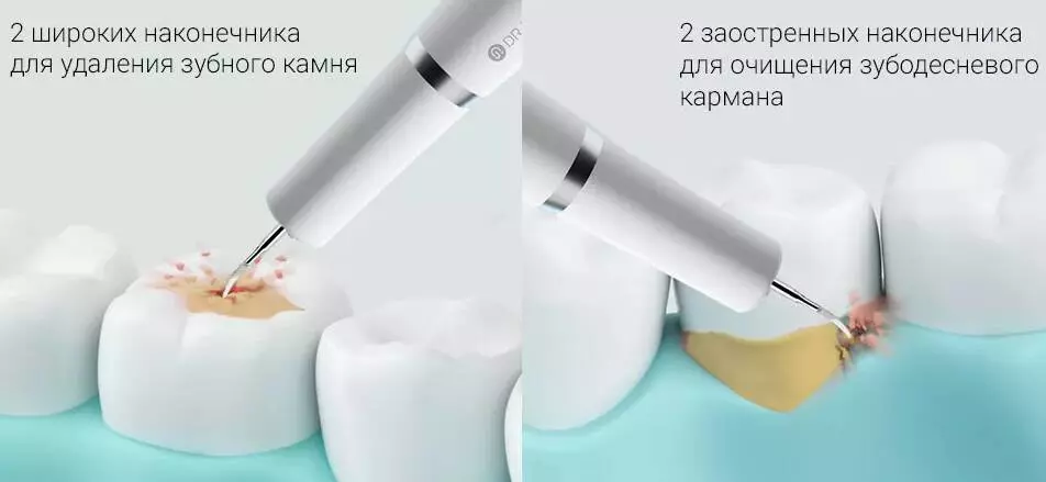 Прибор для удаления зубного камня Xiaomi Dr.Bei Ultrasonic Dental Cleaner YC2 - фото 5 Прибор для удаления зубного камня Xiaomi Dr.Bei Ultrasonic Dental Cleaner YC2 - фото 5