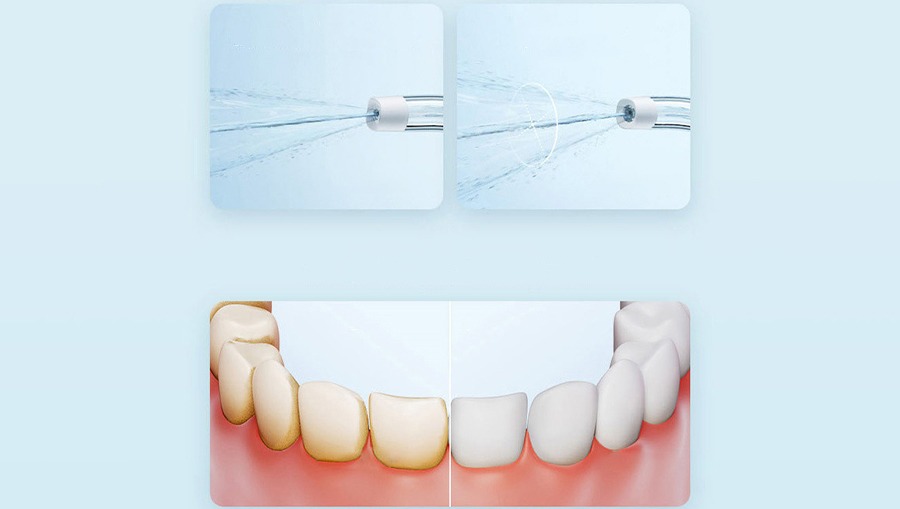 Ирригатор Xiaomi Mijia Electric Teeth Flosser F300 (MEO703) - фото 2